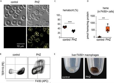 Acute Hemolysis and Heme Suppress Anti-CD40 Antibody-Induced Necro-Inflammatory Liver Disease